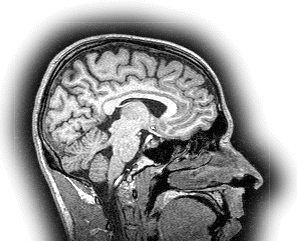 Sagittal head MRI