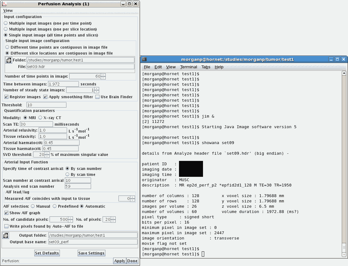 JIM Perfusion
Analysis window
