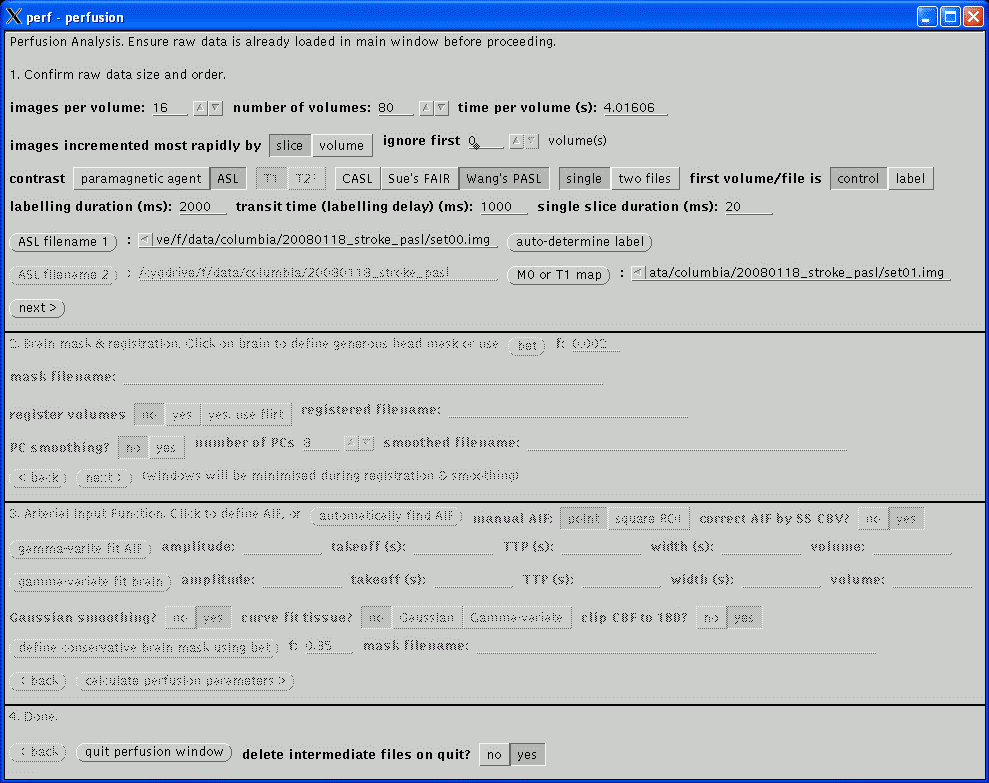 perfusion analysis window